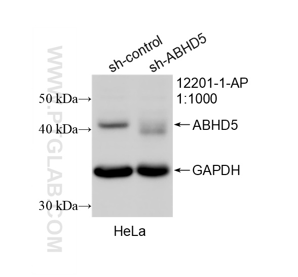 WB result of ABHD5 antibody (12201-1-AP; 1:1000; incubated at room temperature for 1.5 hours) with sh-Control and sh-ABHD5 transfected HeLa cells. WB analysis of HeLa using 12201-1-AP