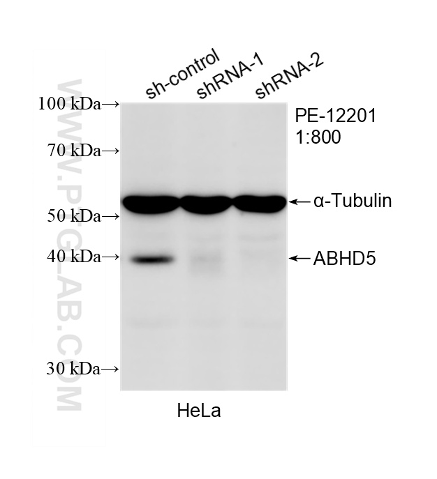 WB analysis of HeLa using PE-12201