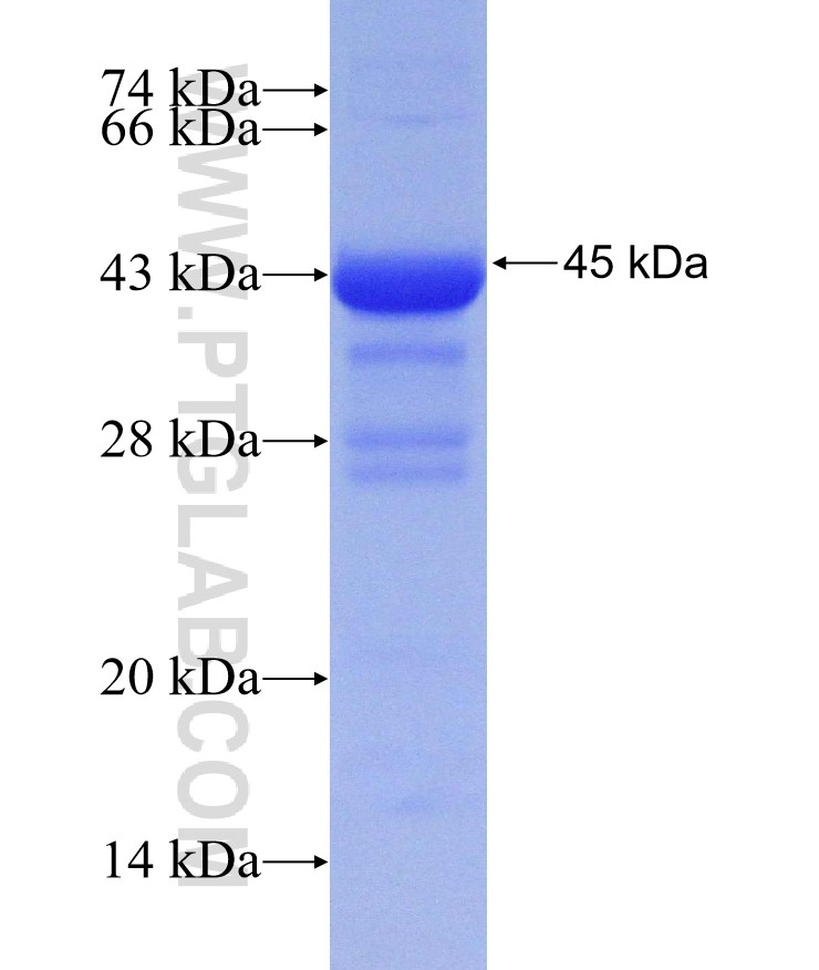 ABHD5 fusion protein Ag30256 SDS-PAGE