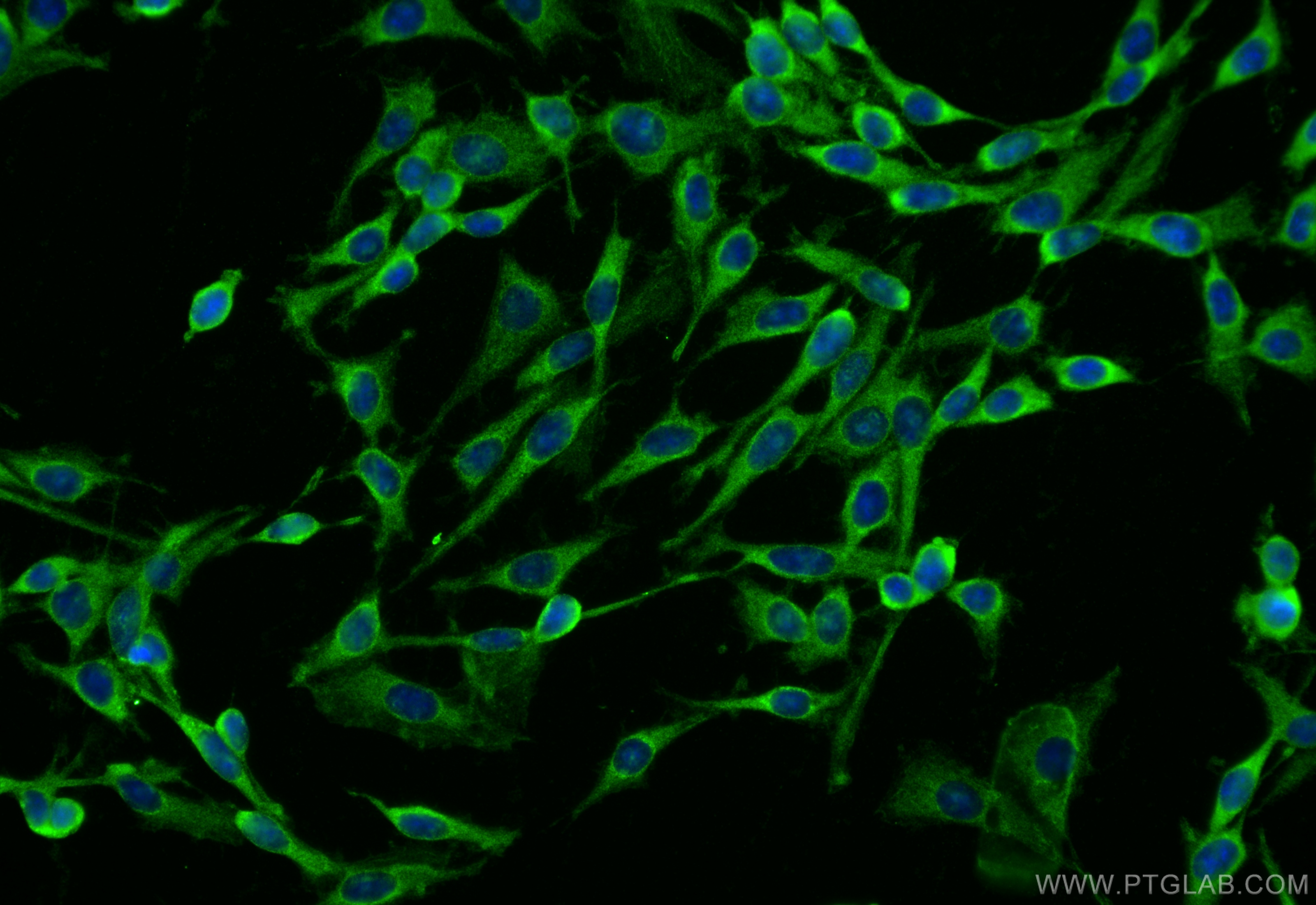 Immunofluorescent analysis of (-20°C Ethanol) fixed C6 cells using ABHD6 antibody (20494-1-AP) at dilution of 1:400 and CoraLite®488-Conjugated Goat Anti-Rabbit IgG(H+L) (<a class='green' href='/productredirect?CatalogNo=SA00013-2' target='_blank'>SA00013-2</a>). IF Staining of C6 using 20494-1-AP
