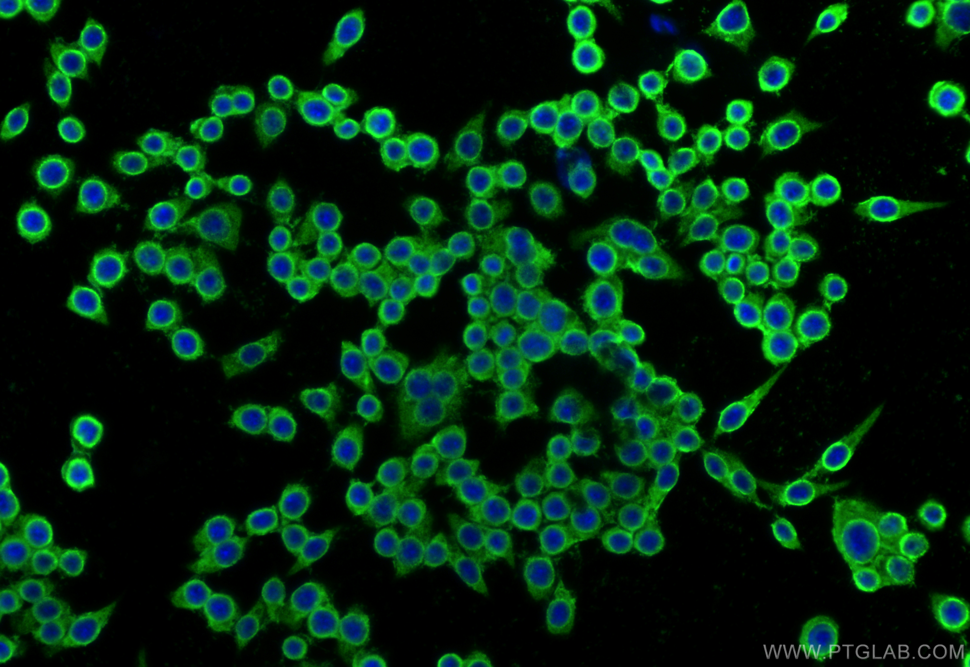 Immunofluorescent analysis of (-20°C Ethanol) fixed RAW 264.7 cells using ABHD6 antibody (20494-1-AP) at dilution of 1:400 and CoraLite®488-Conjugated Goat Anti-Rabbit IgG(H+L) (<a class='green' href='/productredirect?CatalogNo=SA00013-2' target='_blank'>SA00013-2</a>). IF Staining of RAW 264.7 using 20494-1-AP