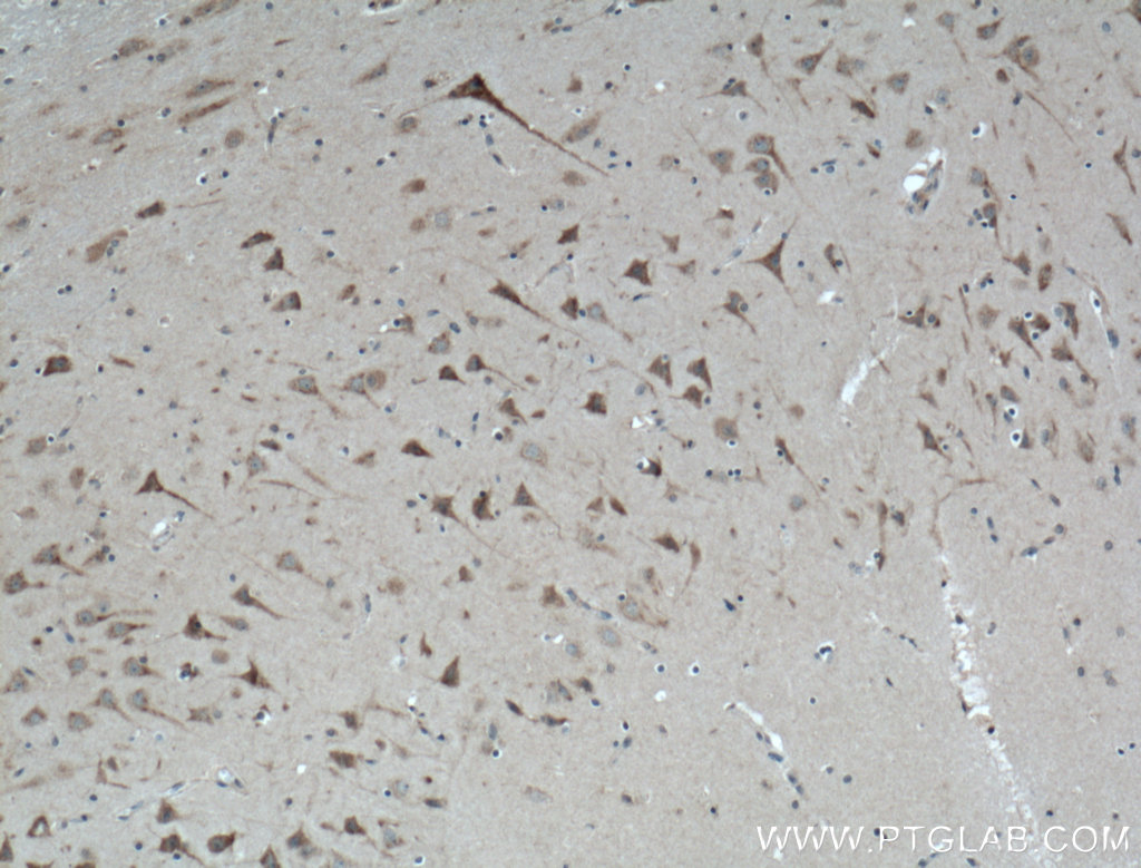 IHC staining of human brain using 20494-1-AP