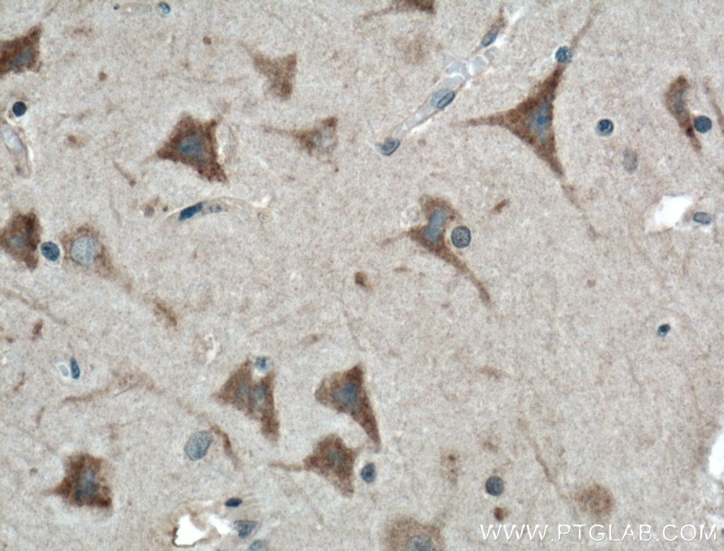 IHC staining of human brain using 20494-1-AP