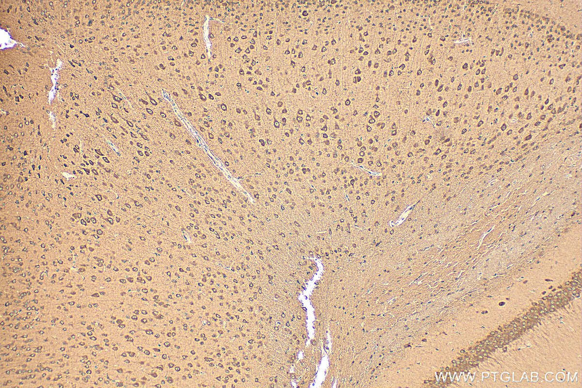 IHC staining of mouse brain using 20494-1-AP