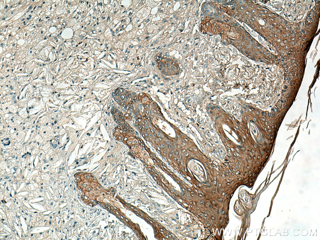 IHC staining of mouse skin using 27387-1-AP