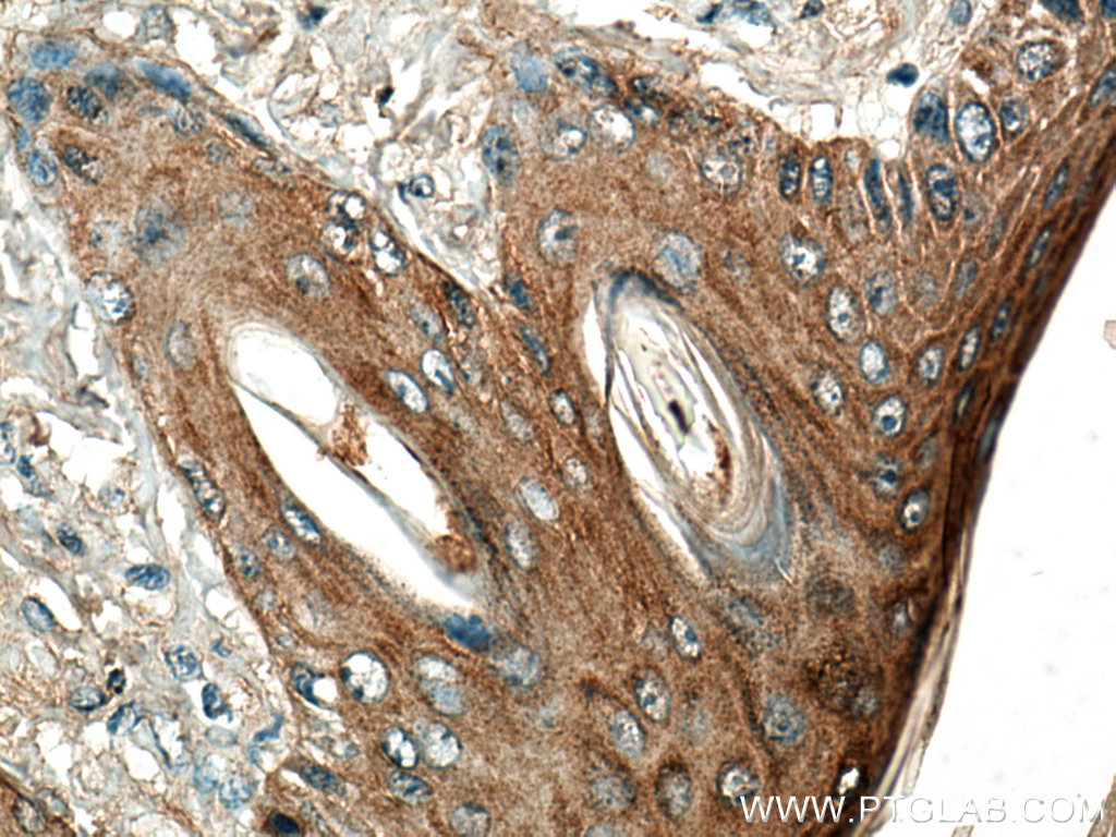 IHC staining of mouse skin using 27387-1-AP