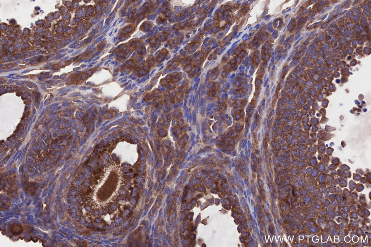 IHC staining of mouse ovary using 27387-1-AP