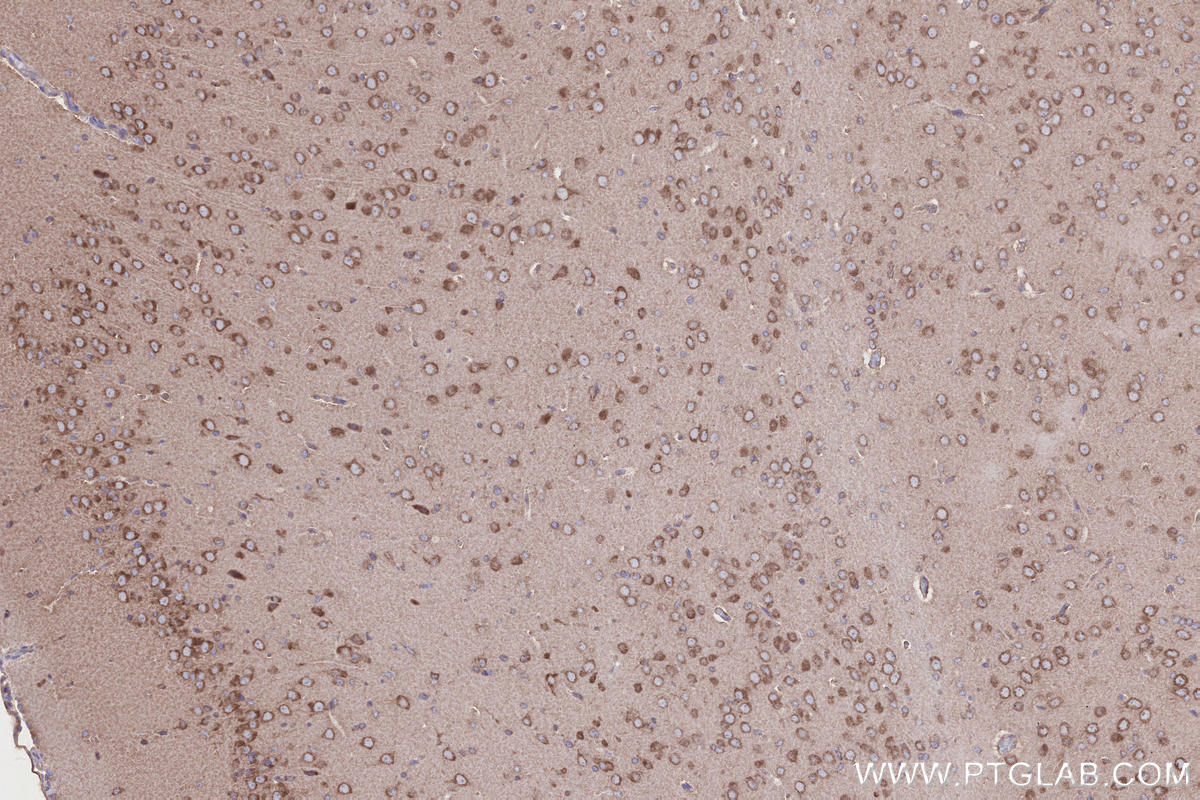 IHC staining of rat brain using 27387-1-AP