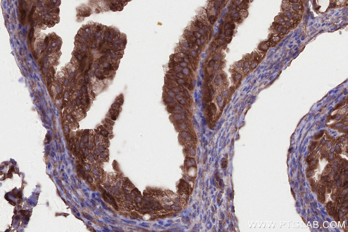 IHC staining of mouse ovary using 27387-1-AP