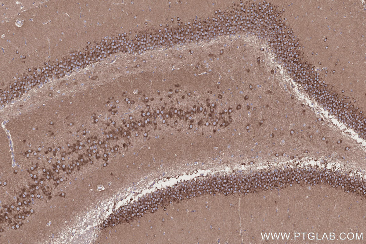 IHC staining of rat brain using 27387-1-AP