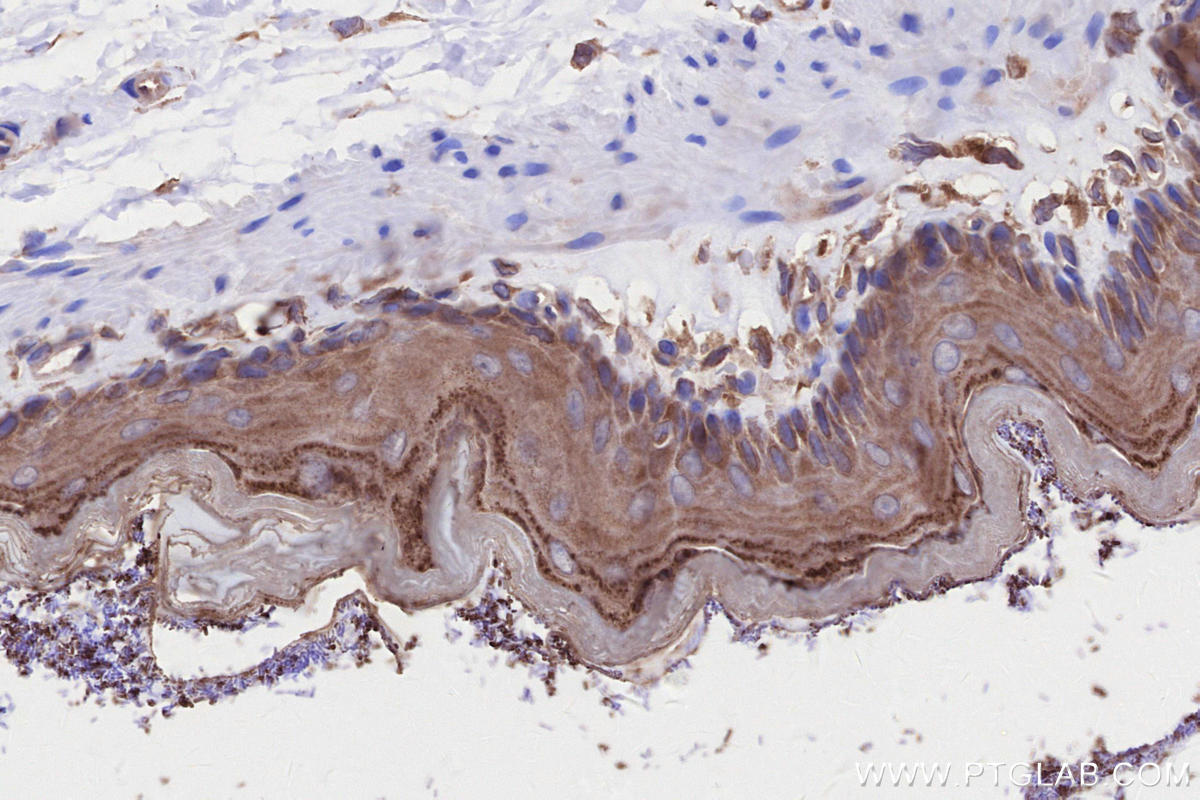 IHC staining of rat stomach using 27387-1-AP