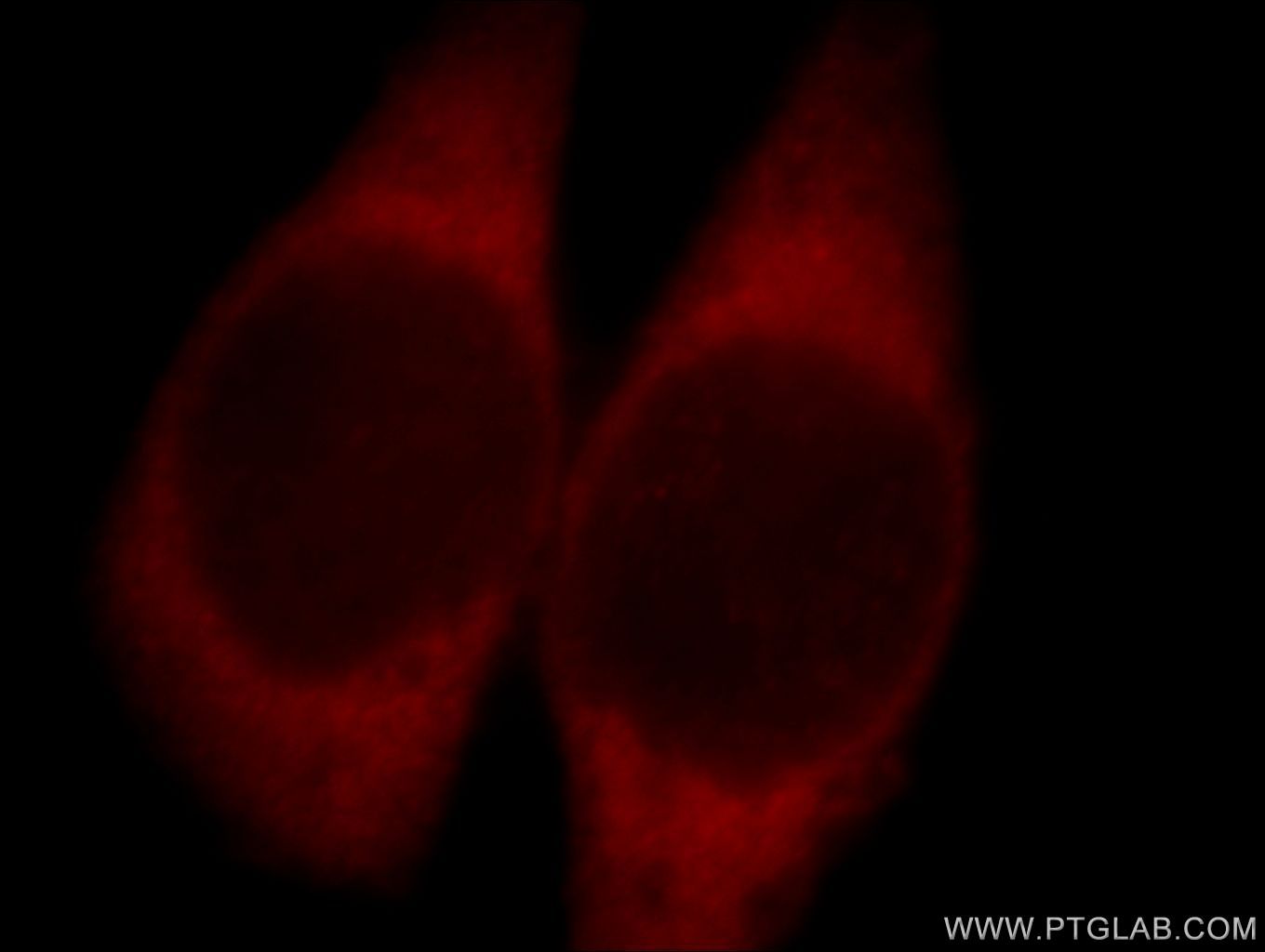 ABI2 Polyclonal antibody