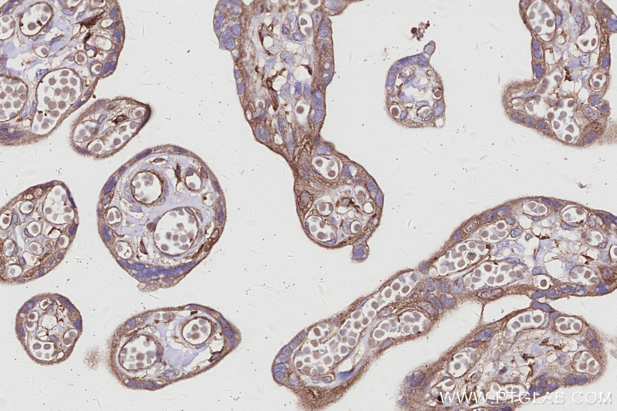 IHC staining of human placenta using 14890-1-AP