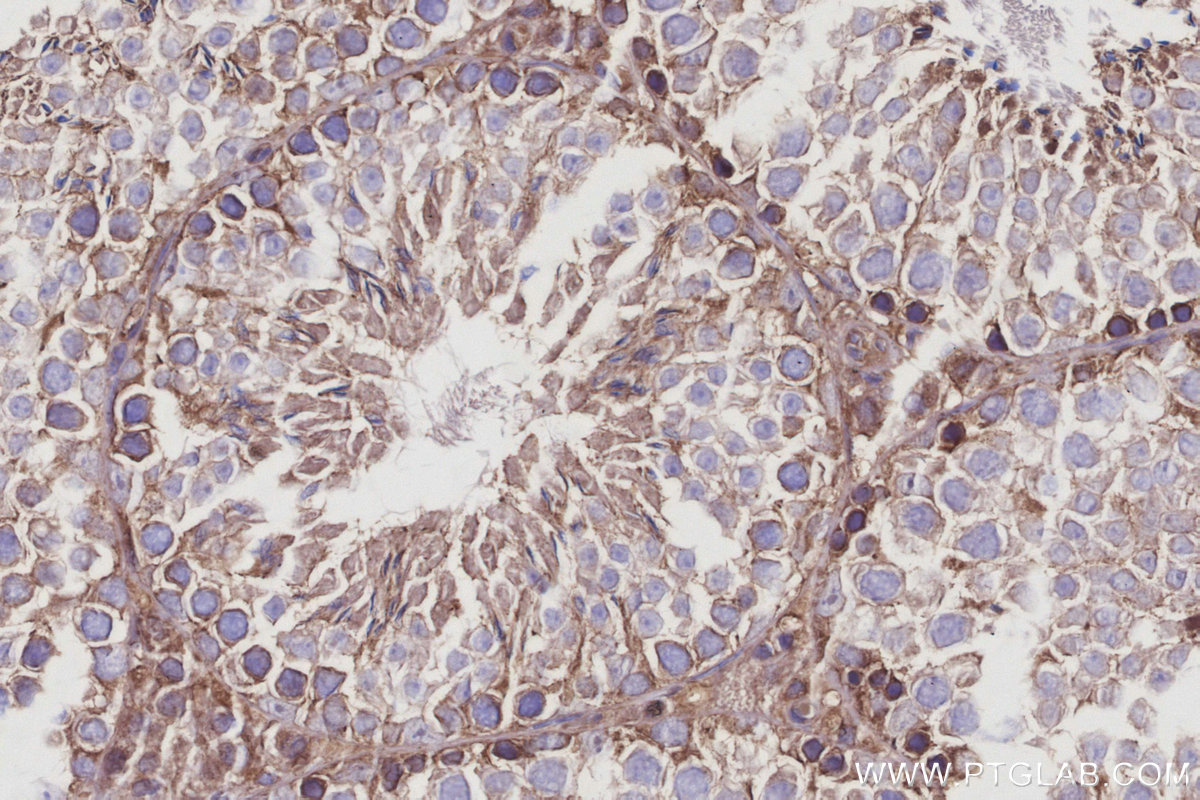 IHC staining of mouse testis using 14890-1-AP