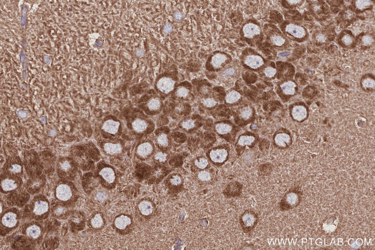 IHC staining of rat brain using 14890-1-AP