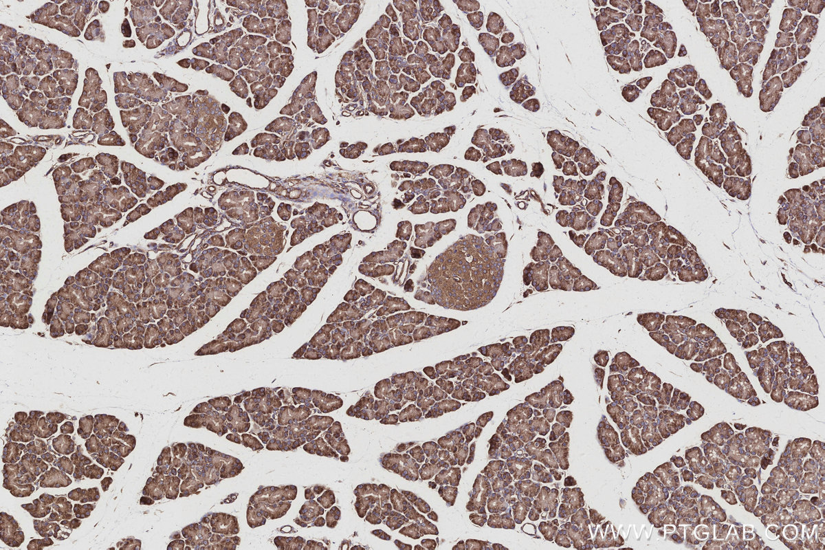 IHC staining of rat pancreas using 14890-1-AP