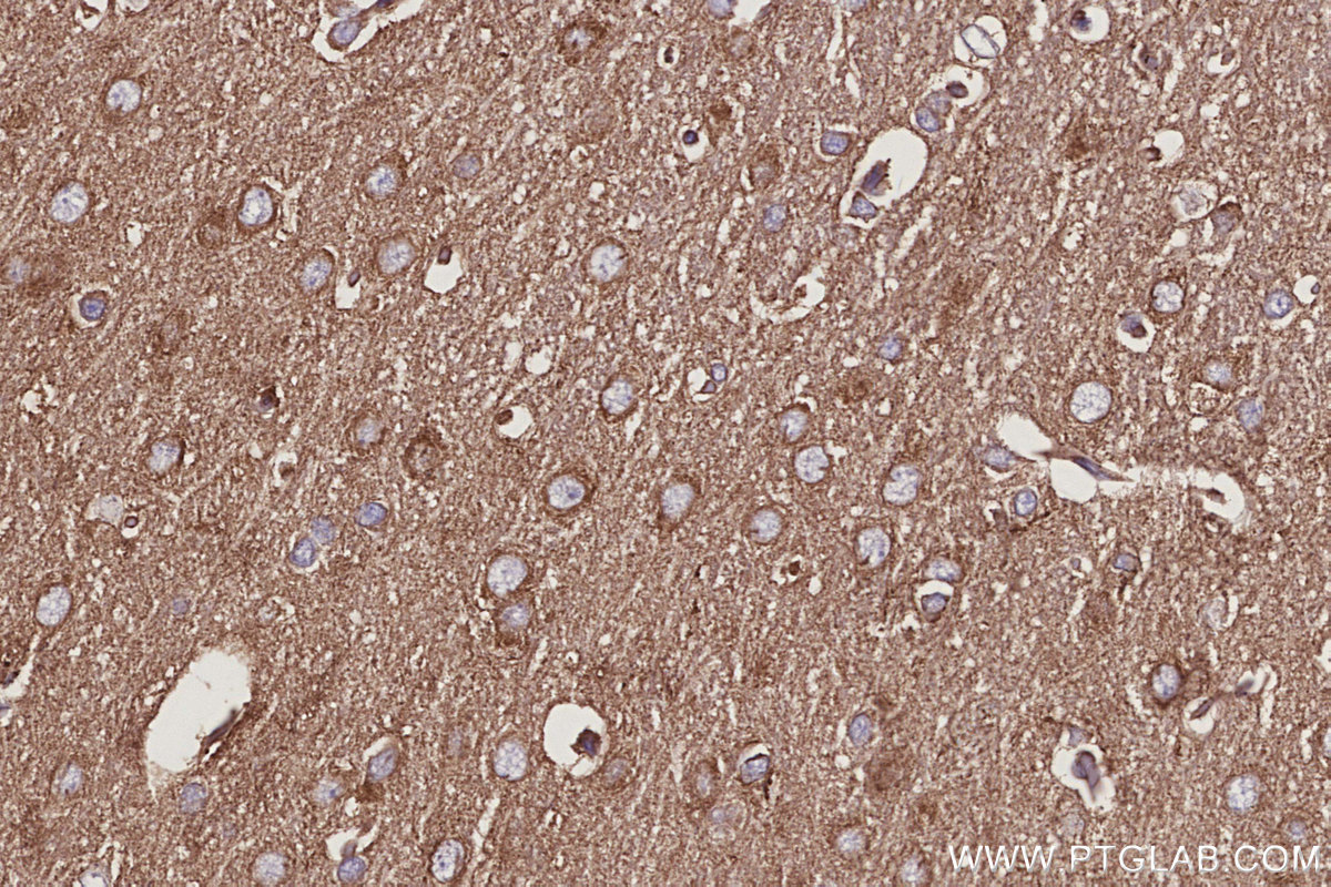 IHC staining of rat brain using 14890-1-AP