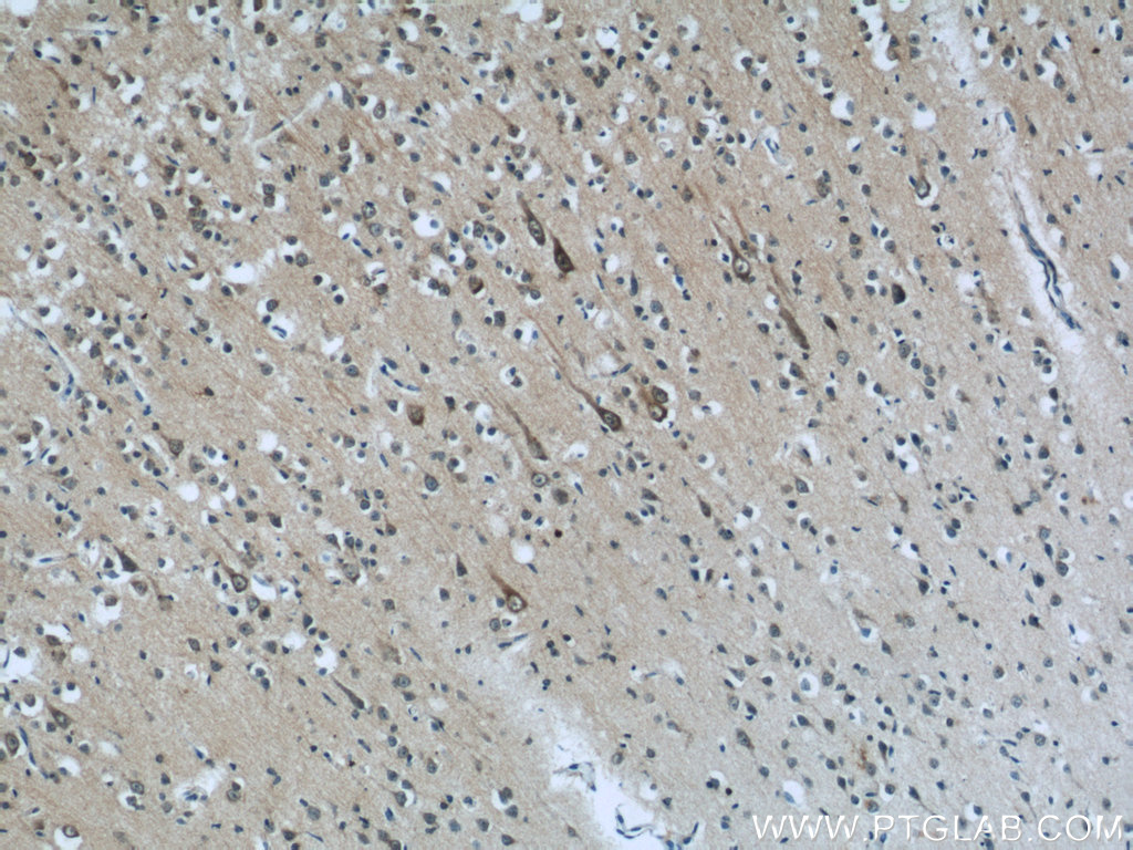 IHC staining of human brain using 14890-1-AP