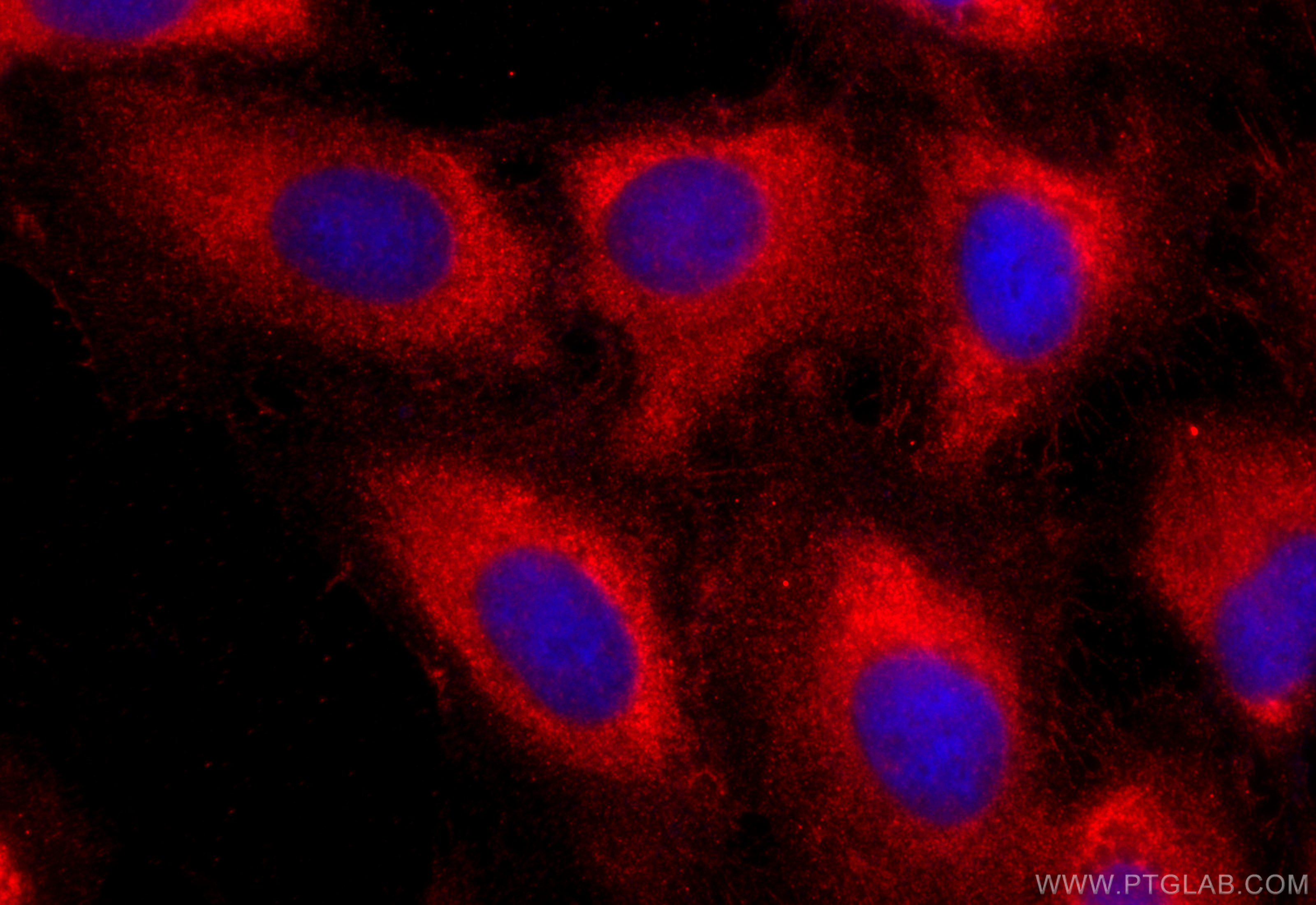 IF Staining of U2OS using 16227-1-AP