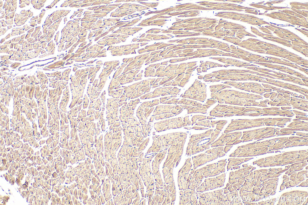 IHC staining of mouse heart using 16227-1-AP