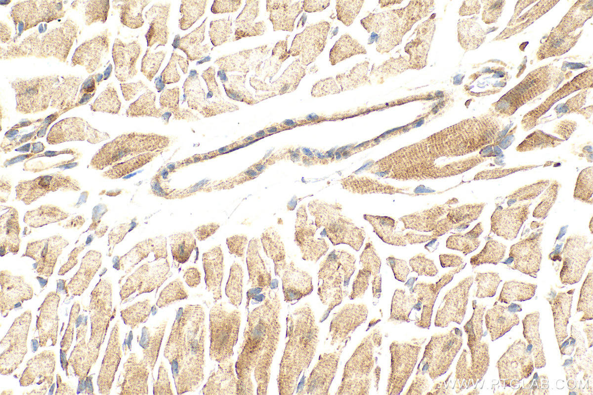 IHC staining of mouse heart using 16227-1-AP