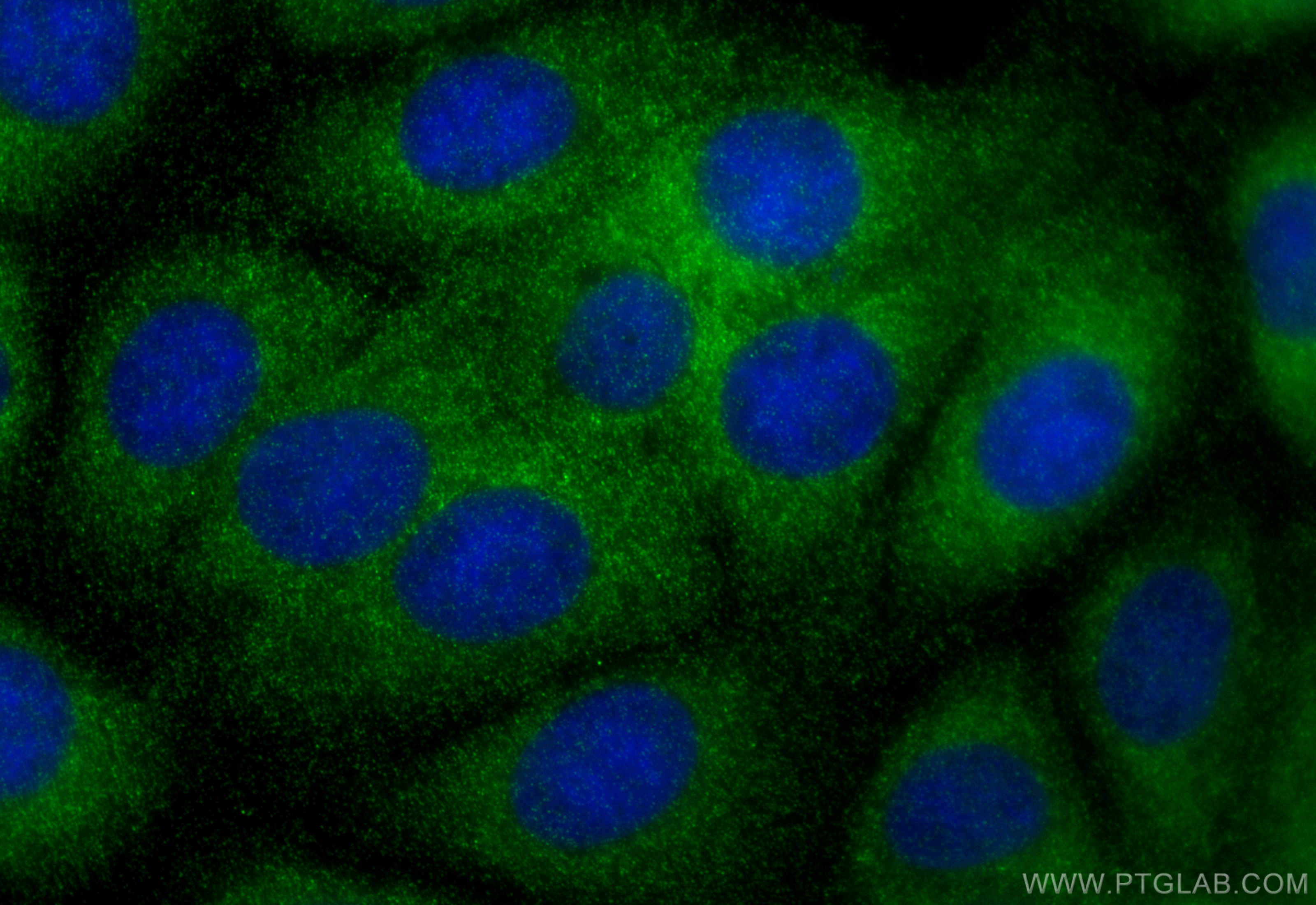 IF Staining of MCF-7 using 32207-1-AP