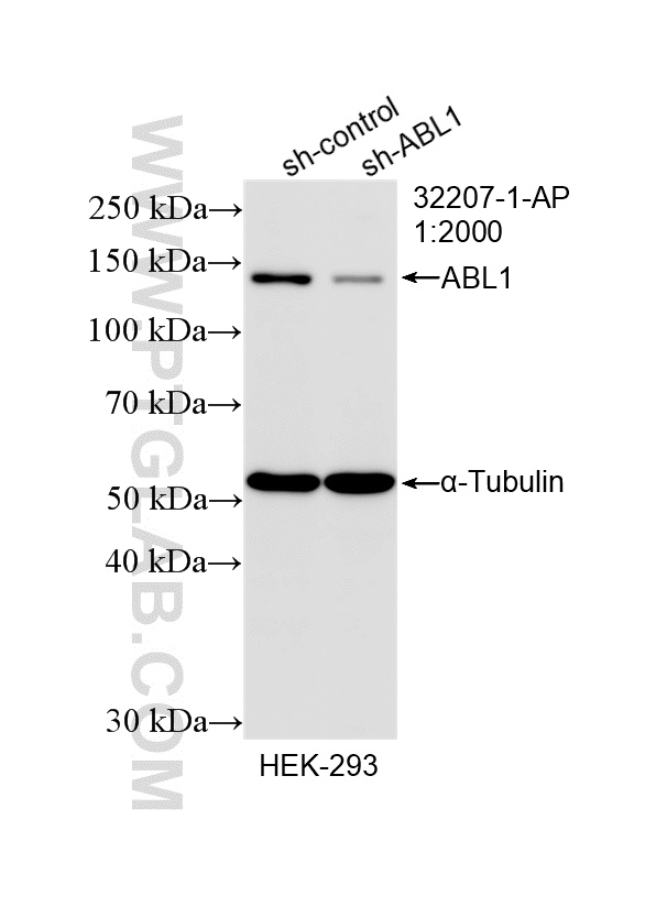 WB result of ABL1 antibody (32207-1-AP; 1:2000; incubated at room temperature for 1.5 hours) with sh-Control and sh-ABL1 transfected HEK-293 cells. WB analysis of HEK-293 using 32207-1-AP