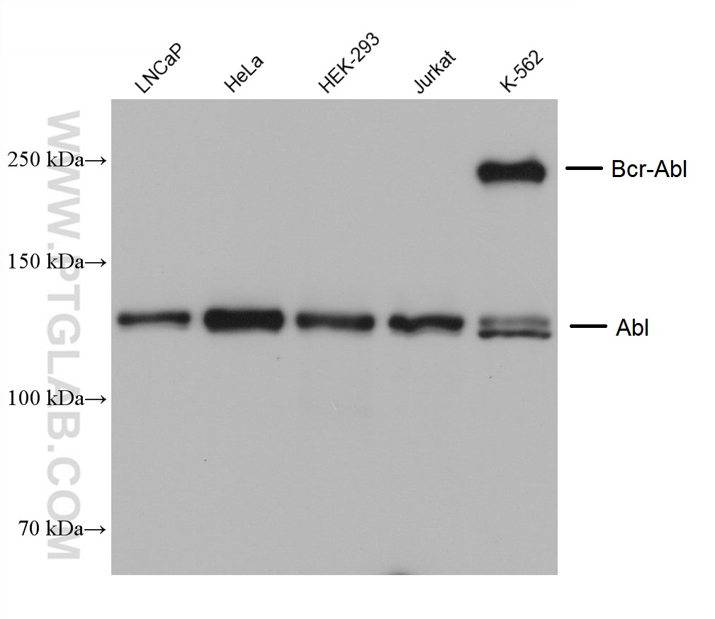 WB analysis using 68254-1-Ig