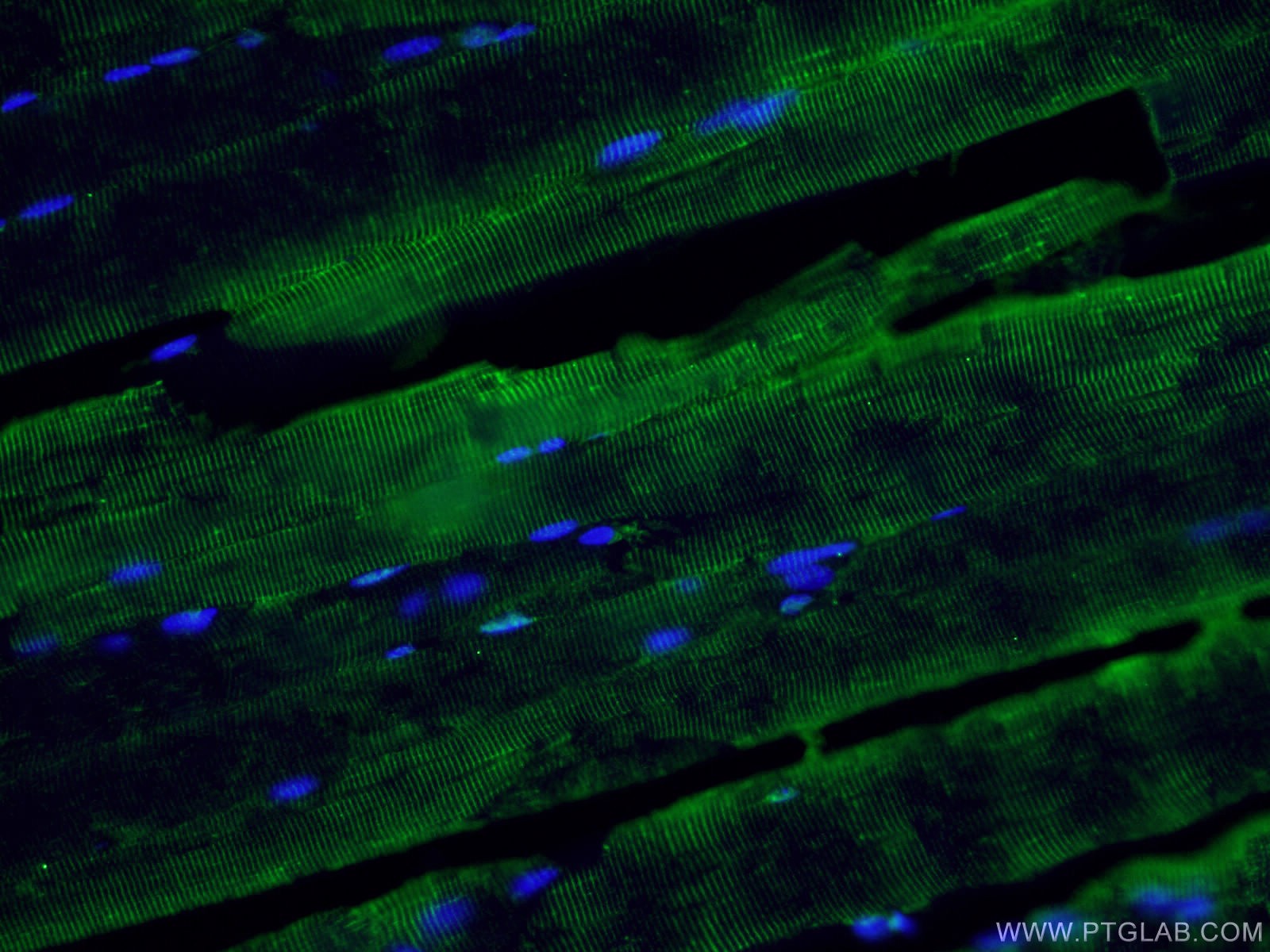 IF Staining of mouse skeletal muscle using 15129-1-AP