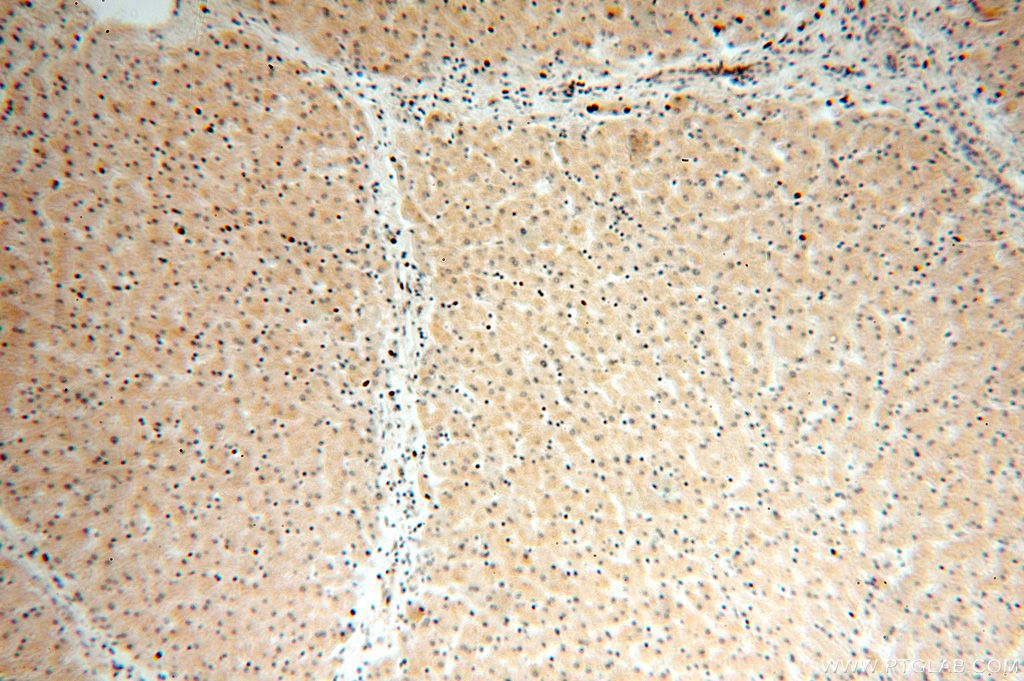 IHC staining of human liver using 15129-1-AP