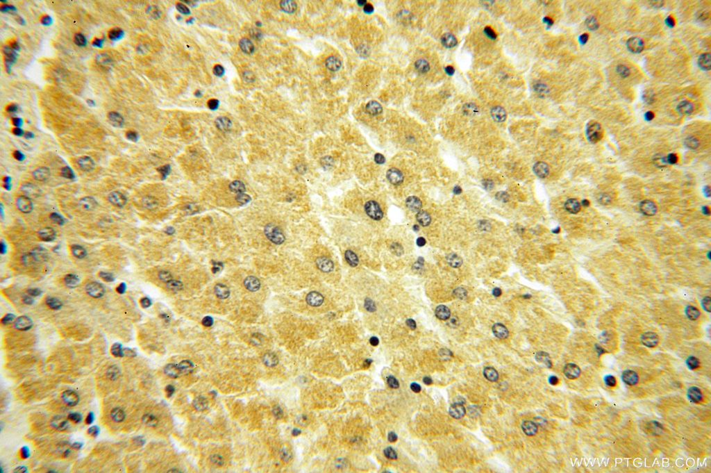 IHC staining of human liver using 15129-1-AP