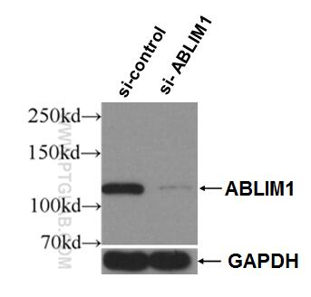 WB analysis of HeLa using 15129-1-AP