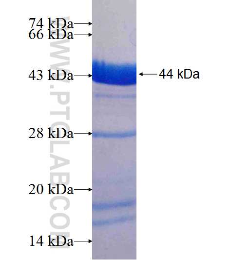 ABLIM1 fusion protein Ag7080 SDS-PAGE ABLIM1 fusion protein Ag7080 SDS-PAGE