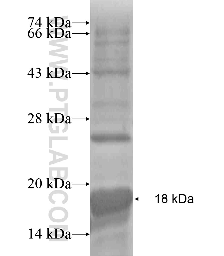 ABLIM2 fusion protein Ag18508 SDS-PAGE ABLIM2 fusion protein Ag18508 SDS-PAGE