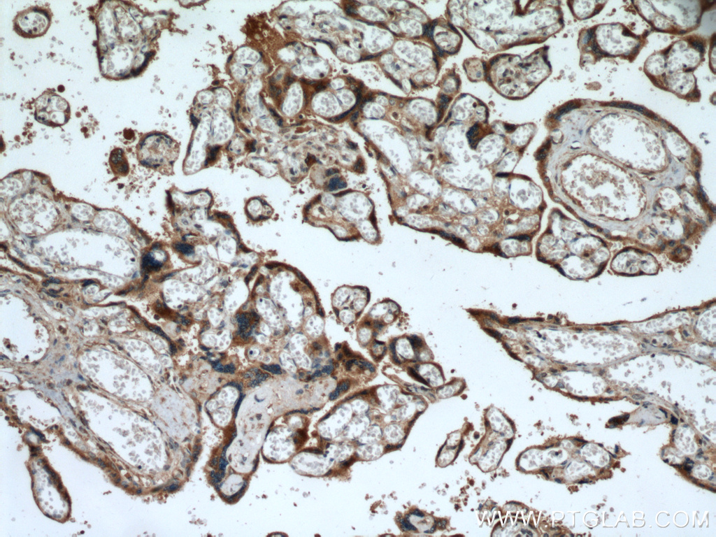 IHC staining of human placenta using 27814-1-AP