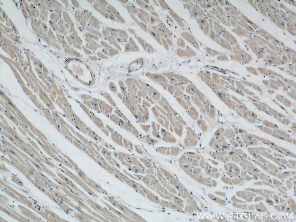 IHC staining of human heart using 22673-1-AP