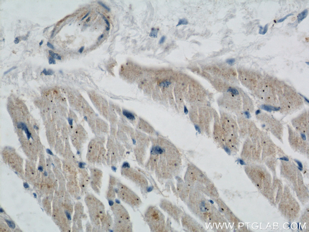 IHC staining of human heart using 22673-1-AP