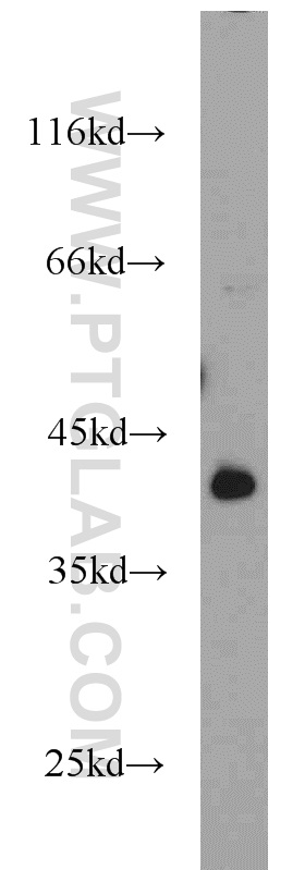 WB analysis of mouse heart using 22673-1-AP