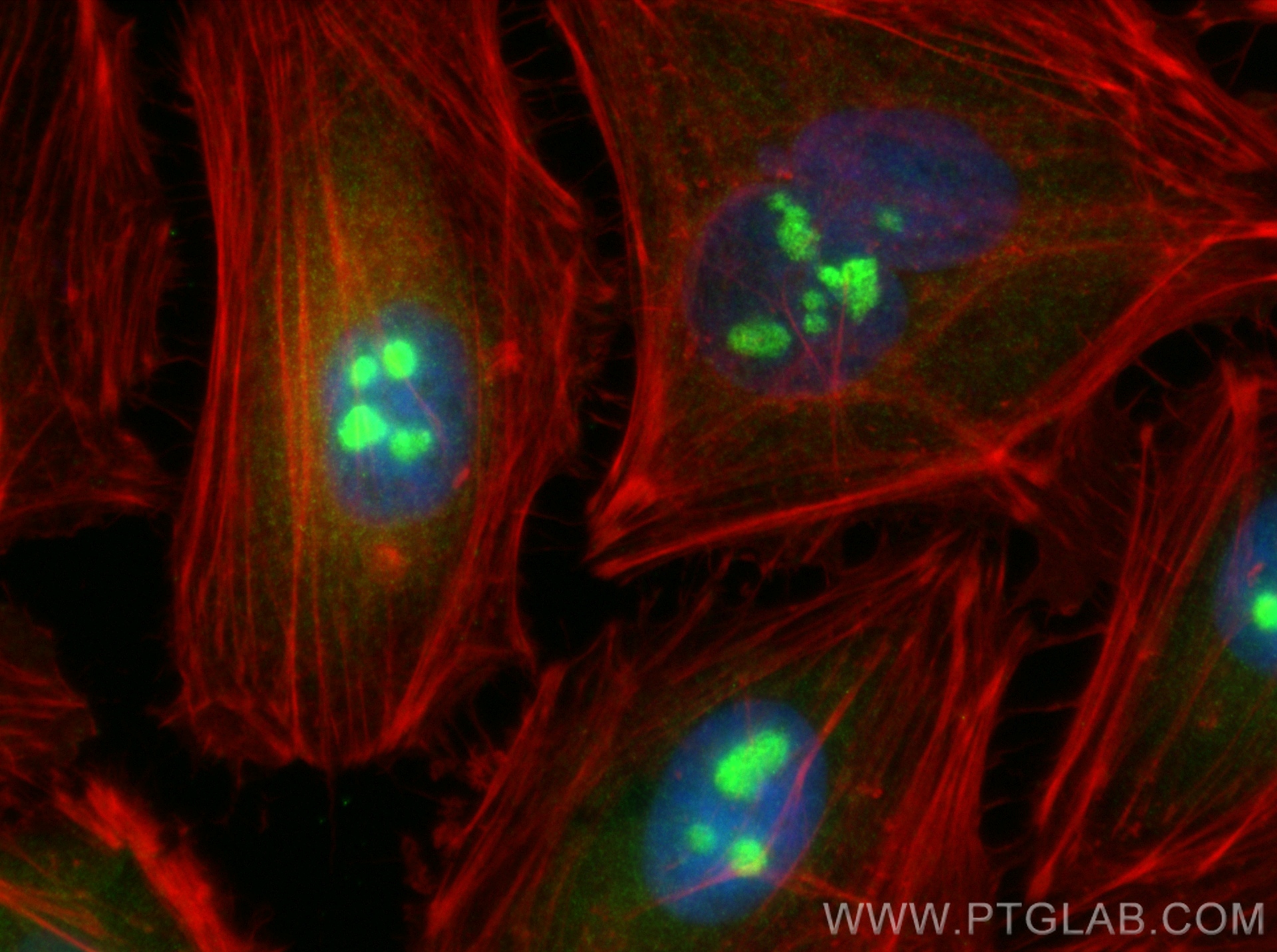 IF Staining of HeLa using 14148-1-AP