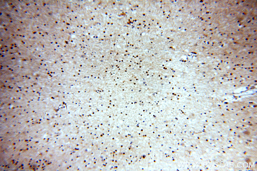 IHC staining of human brain using 14148-1-AP