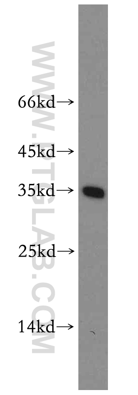 WB analysis of mouse liver using 14148-1-AP