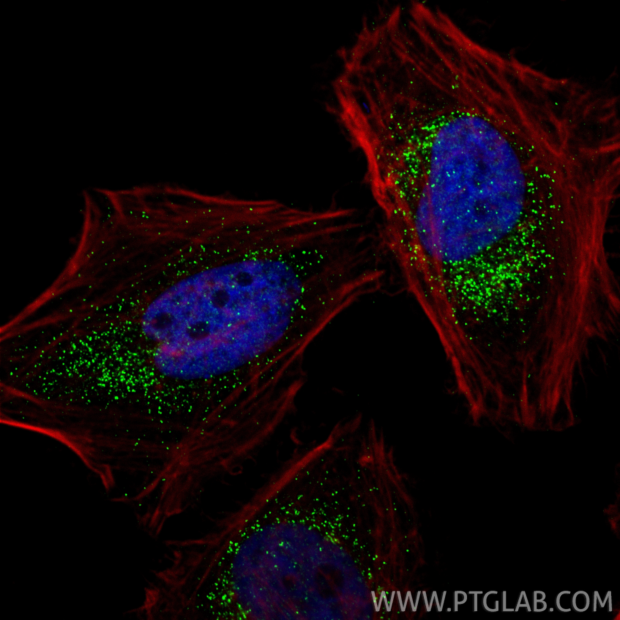 IF Staining of HeLa using 12319-2-AP IF Staining of HeLa using 12319-2-AP