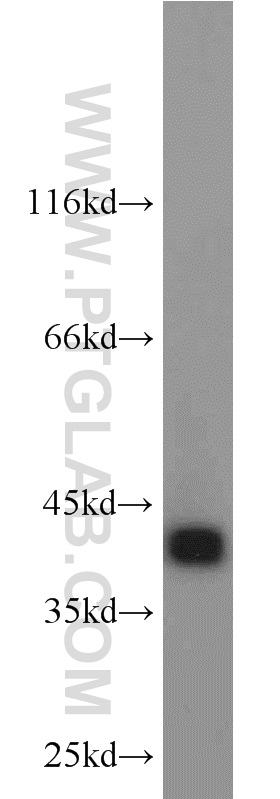 WB analysis of L02 using 12319-2-AP