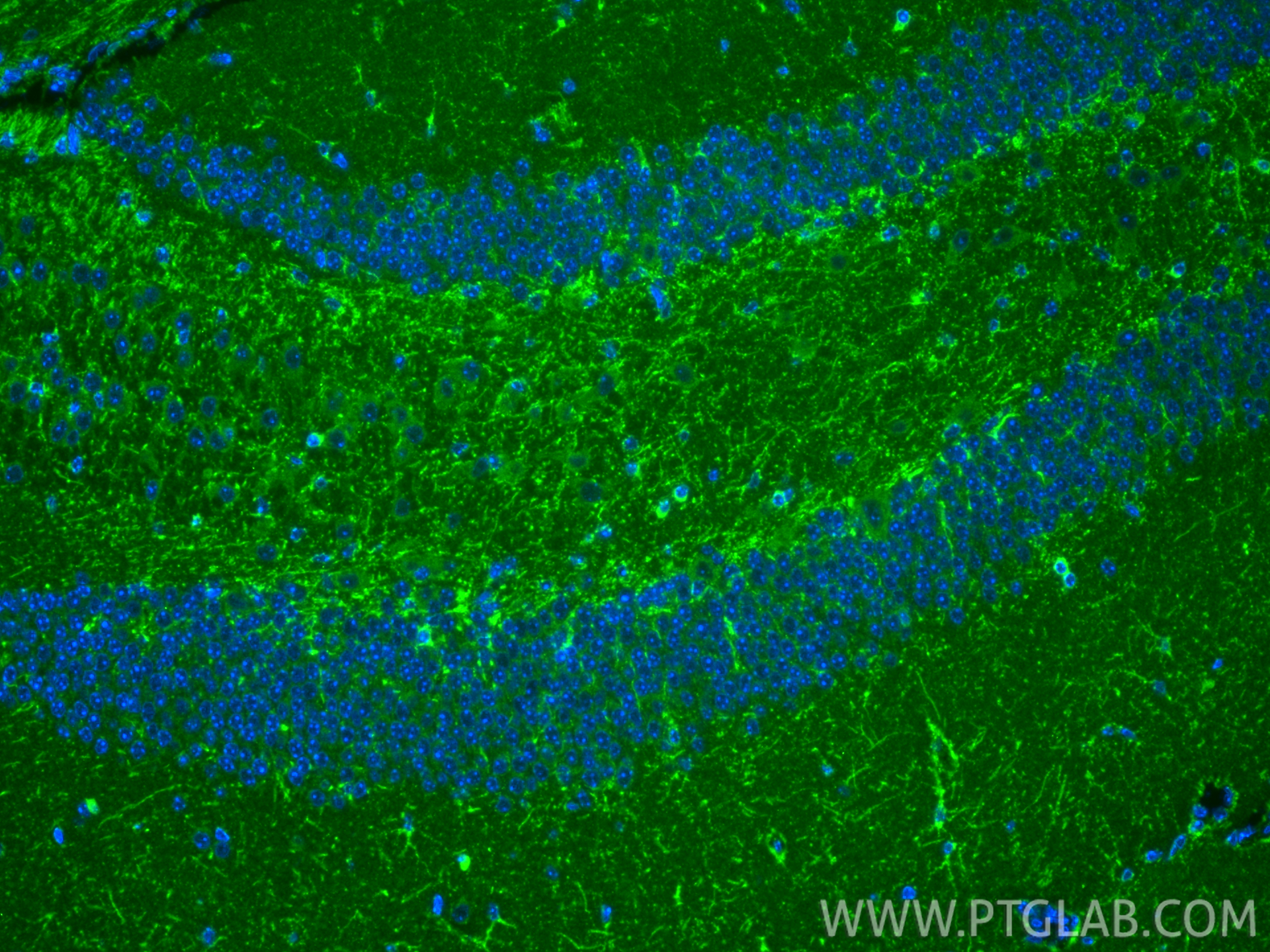 IF Staining of mouse brain using 87969-1-RR (same clone as 87969-1-PBS) IF Staining of mouse brain using 87969-1-RR (same clone as 87969-1-PBS)