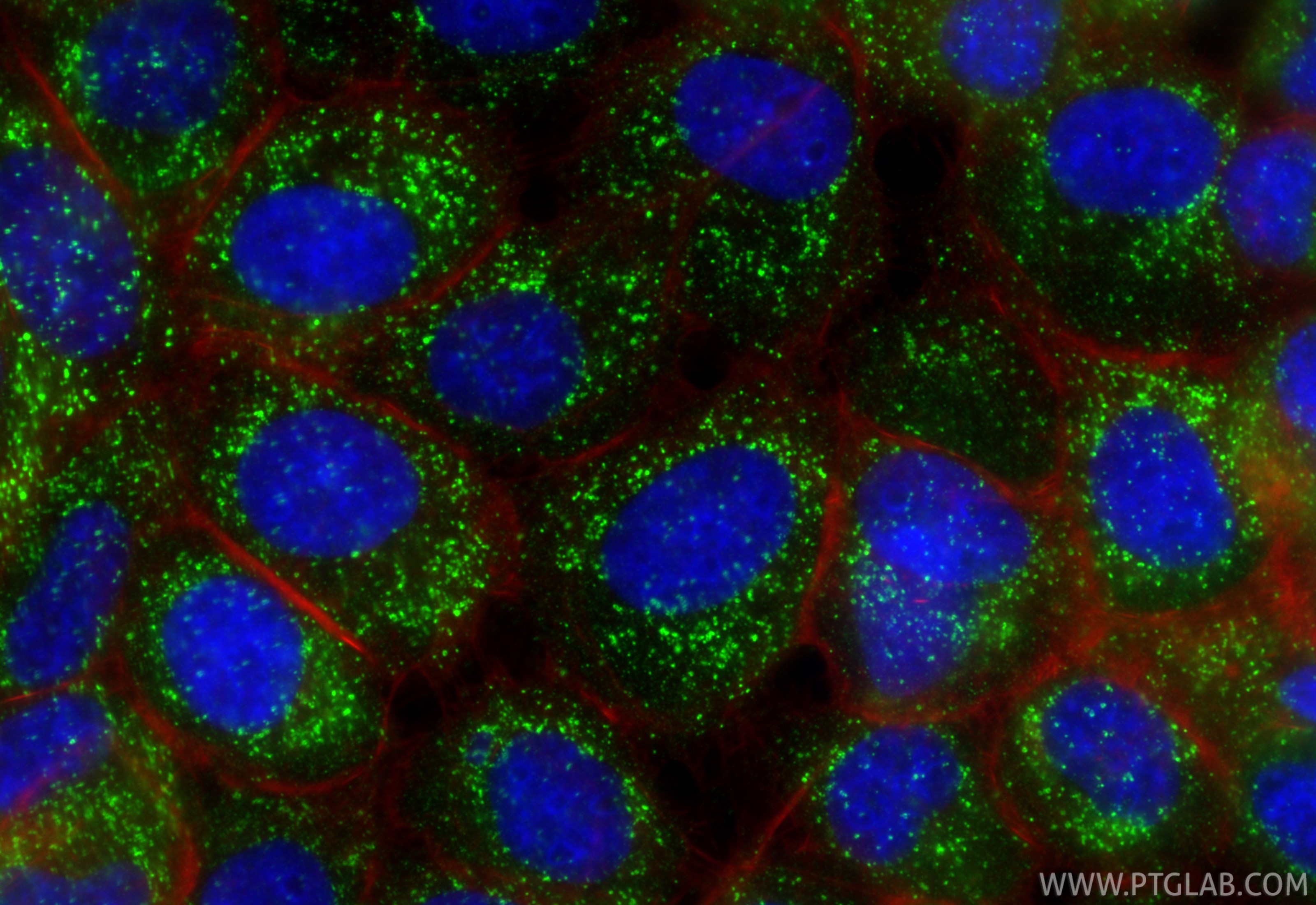 IF Staining of U-251 using 87969-1-RR (same clone as 87969-1-PBS) IF Staining of U-251 using 87969-1-RR (same clone as 87969-1-PBS)