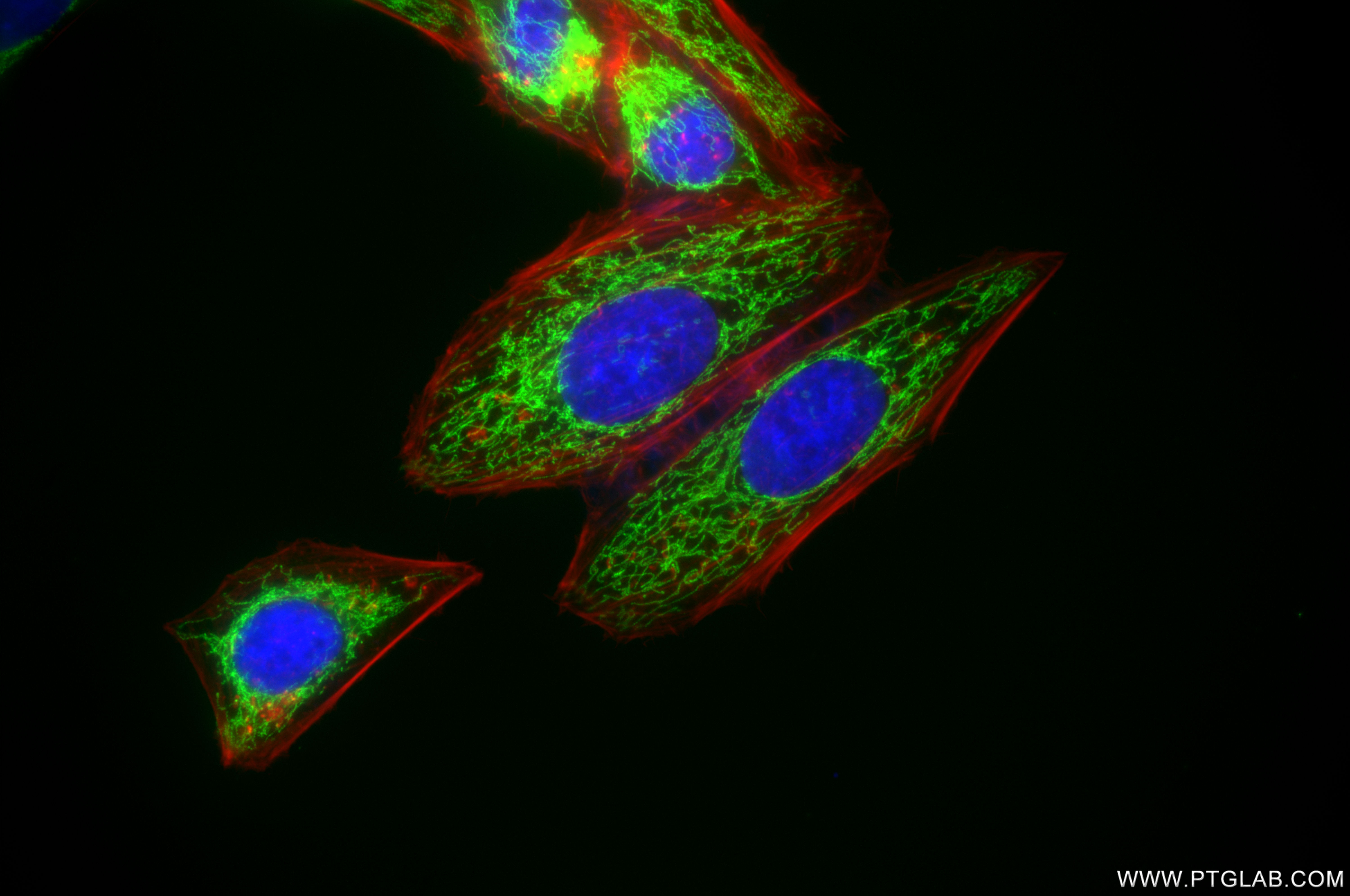IF Staining of HepG2 using 86161-3-RR