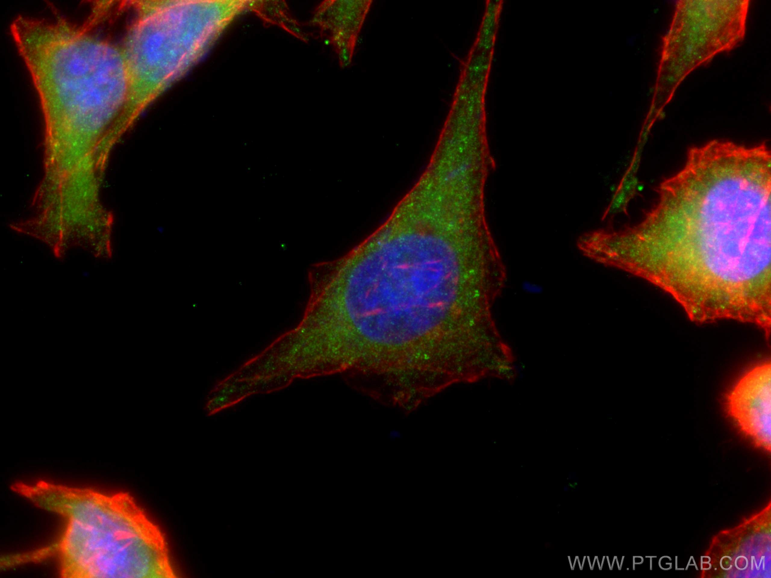 IF Staining of HeLa using 21923-1-AP