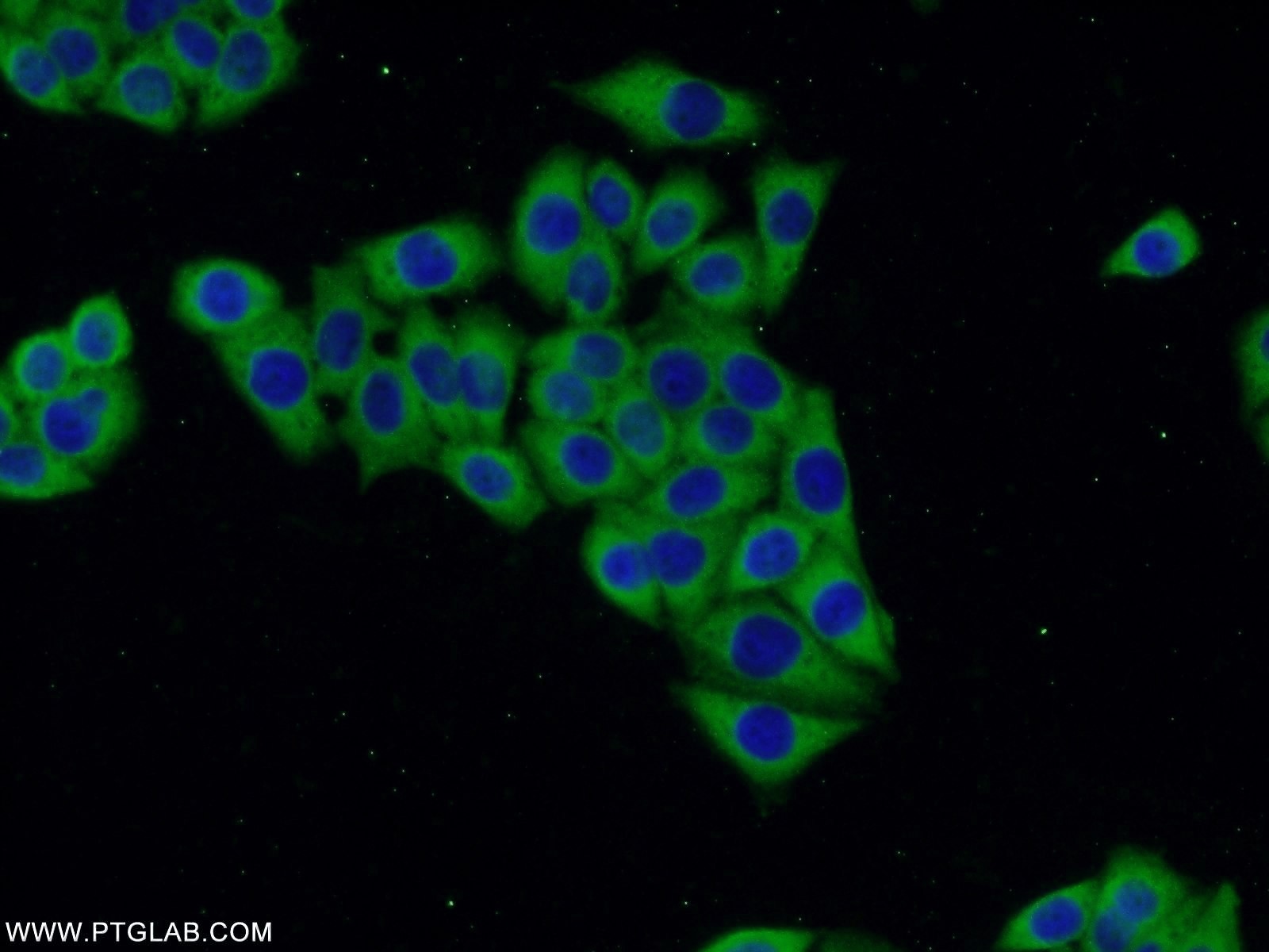 acc1-antibody-21923-1-ap-proteintech