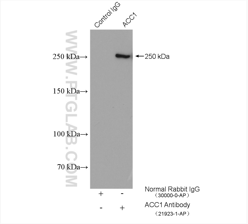 IP experiment of HepG2 using 21923-1-AP