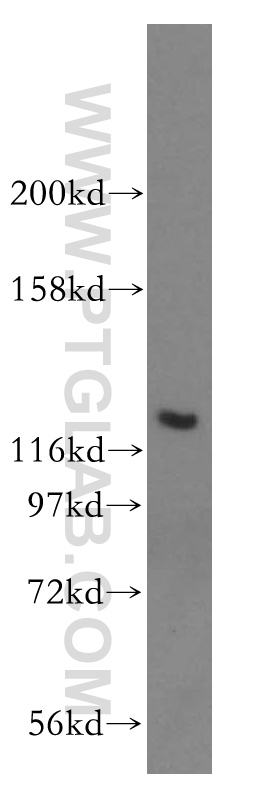 WB analysis of mouse spleen using 17161-1-AP
